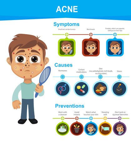 Acne Symptoms, Causes and Preventions. Boy with symptoms. Whiteheads, blackheads, small red, tender bumps.のイラスト素材