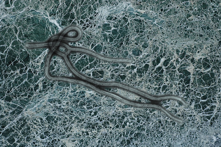 Ebola virus seen under a microscope with epidemic signの写真素材