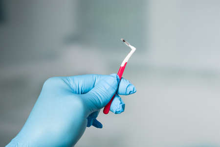 Dentist's hand in blue gloves with interdental brushの写真素材