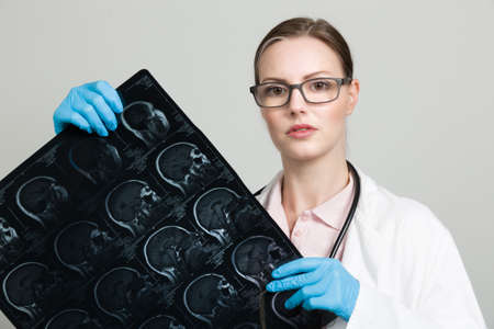 Female doctor with an x-ray image scan of a human head