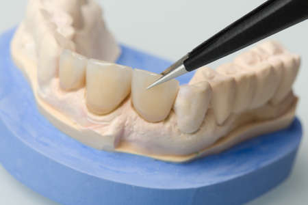 close up of detail working on denture parts in a dental laboratoryの写真素材