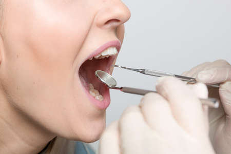 close up of mouth of woman at examination in dentistry / at the dentist with dental instrumentsの写真素材