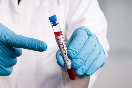 hand in medical gloves presents a blood probe with positive coronavirus result markerの写真素材
