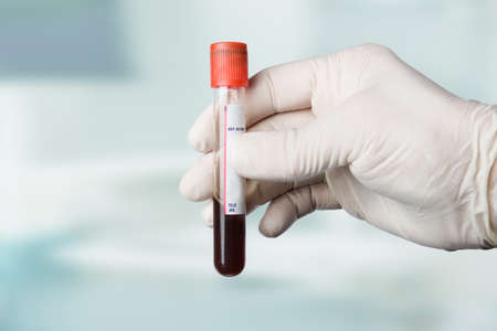 close up of hands handling a blood sampleの写真素材