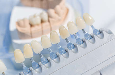 close up of checking veneer of tooth crown or implant with a shade guide in dental laboratoryの写真素材