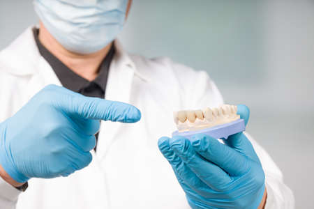 Dentist's or dental technician's hand in gloves is presenting a dental imprint with artificial...