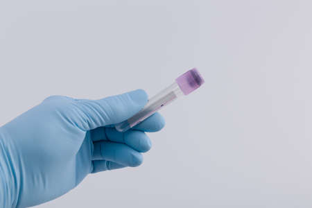 Close up of doctor's hand in medical gloves with an empty blood container for testing in medical laboratoryの写真素材