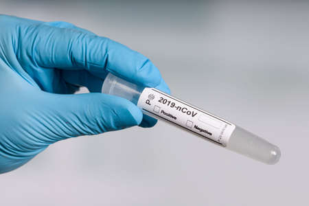 close-up of hand in blue gloves holding an empty test tube for virus analysis with result markers in...