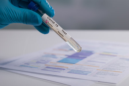 test tube in a laboratory for Coronavirus (COVID-19).