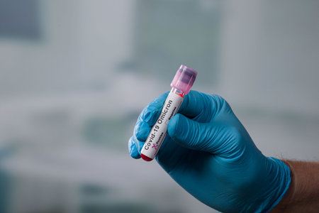 Blood sample for SARS-CoV-2 test in hand of doctorの写真素材