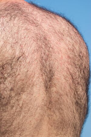 a lot of hair on the male backの写真素材