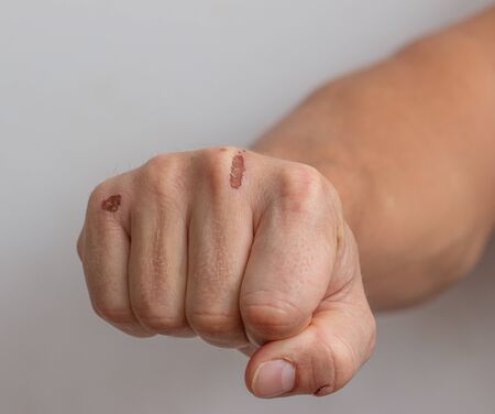 skin damage on the arm