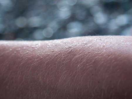 water droplets on the skin as background