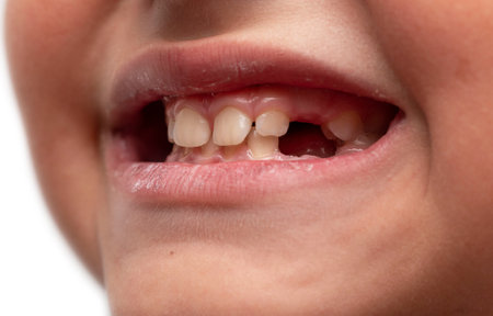 a baby's mouth with a missing milk toothの写真素材