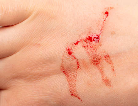 scratch with streaks of blood on the skin of the handの写真素材