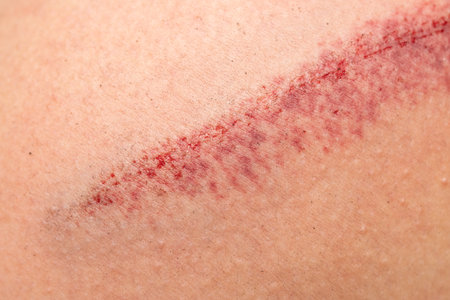 large deep scratch on the skinの写真素材