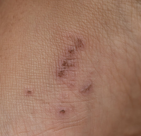 scratches on the skin of the leg as a backgroundの写真素材