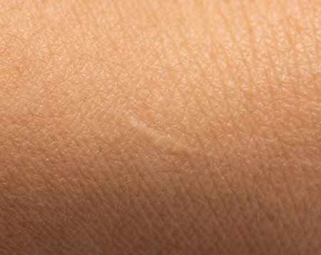 white small scar on skinの写真素材