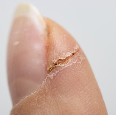 healed cut on a finger as a backgroundの写真素材