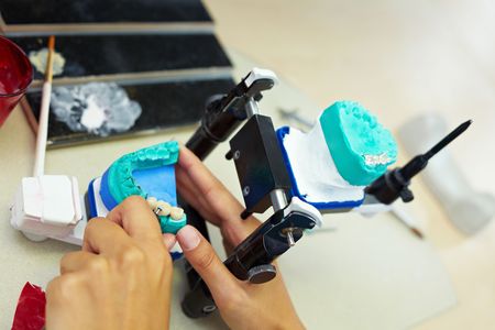 Dental technician grinding a ceramic corona in articulatorの写真素材