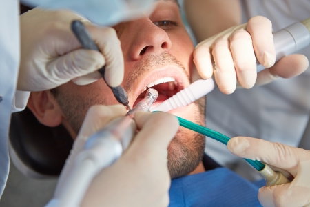 Hands of dentist at dental treatment of patient with toothacheの写真素材
