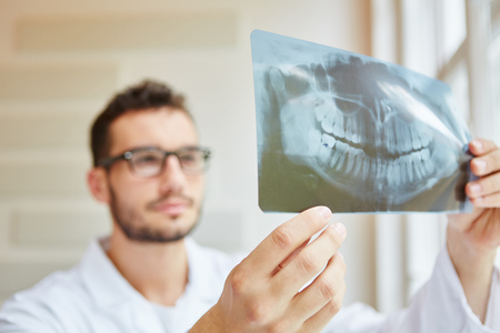 X-ray image on dentist hands making diagnosticの写真素材