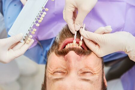 Patient with professional teeth whitening when comparing the tooth color with the dentistの写真素材