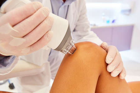 Skin tightening and rejuvenation on the thigh with Fraxel laser therapyの写真素材