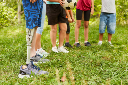 Low section of disabled boy with amputated leg standing with friends at parkの写真素材