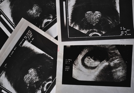 ultrasonic love の写真素材