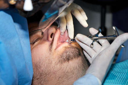 A man with a slight beard undergoing a dental procedureの写真素材