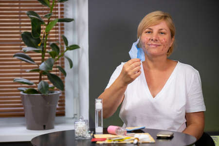 Woman senior aged in medical mask wearing white t-shirt sitting at the table having acne remedy on the table, which she is getting to use to stop the spreading acne on her face.の写真素材