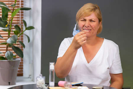 Beautiful caucasian woman having acne problem on the face, feeling irritation and pain after getting off the medical mask.の写真素材