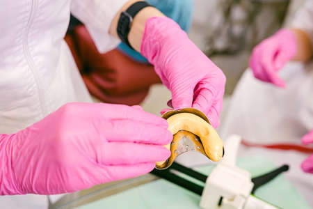 Close-up photo of dentists hands in pink gloves holding teeth impression of a patient and instruments.の写真素材