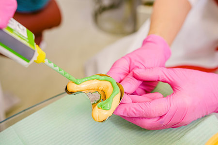 Photo of dentists hands holding teeth impression and assistant helping her to put dental implant using instruments.の写真素材