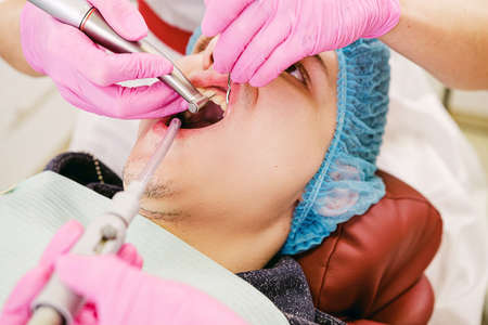 Dentist and dental assistant examining patient man teeth and making dental treatment in the dental clinic.の写真素材