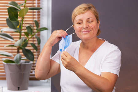 Close up photo of a blonde woman indoors taking off medical mask and realized an acne problem on her face.の写真素材