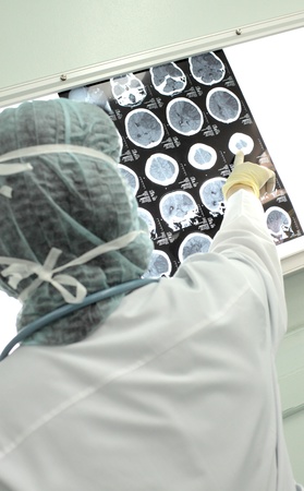 photo female doctor, pointing to the tomogram of the human brainの写真素材