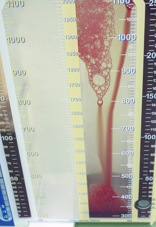 container for blood collection  Surgical instrument used after surgery  Photography