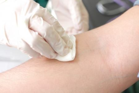 tampon on the hand of a patientの写真素材