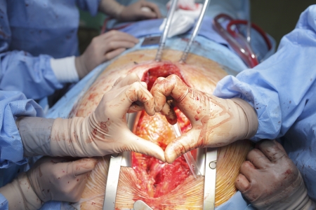 Two hands of surgeons form a heart shape on the background of open heart  Medical concept の写真素材