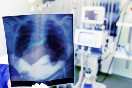 Demonstration of an x-ray in clinicの写真素材
