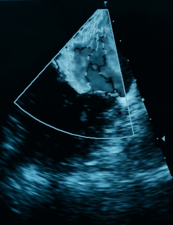 Screen ultrasound machine  symbol diagnostics in healthcareの写真素材