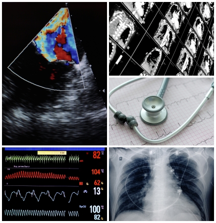 Medical Collage  advanced equipment and methods of diagnosis in medicineの写真素材