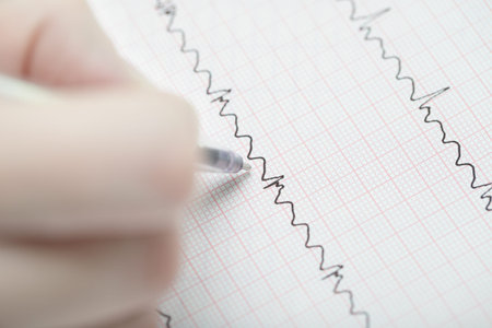 Analyzing of ECG  Hand with a pen on the ECG 
