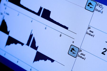 Monitor screen with variable curves  Business concept の写真素材