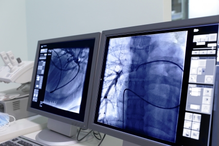 Monitor screen in radiology の写真素材