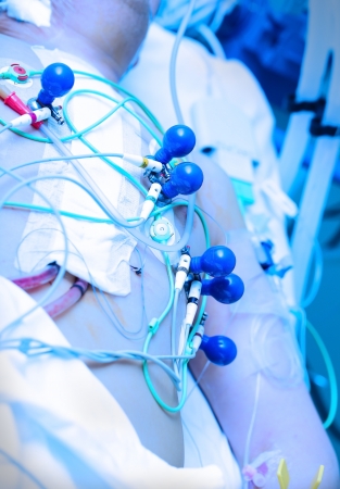 ECG recording  Cardiographic machine electrodes on the patient の写真素材