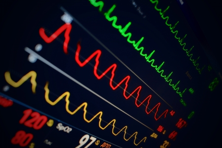 medical Monitor with different indicesの写真素材