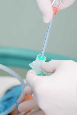 sanation of trachea  Working with patients in the ICU の写真素材